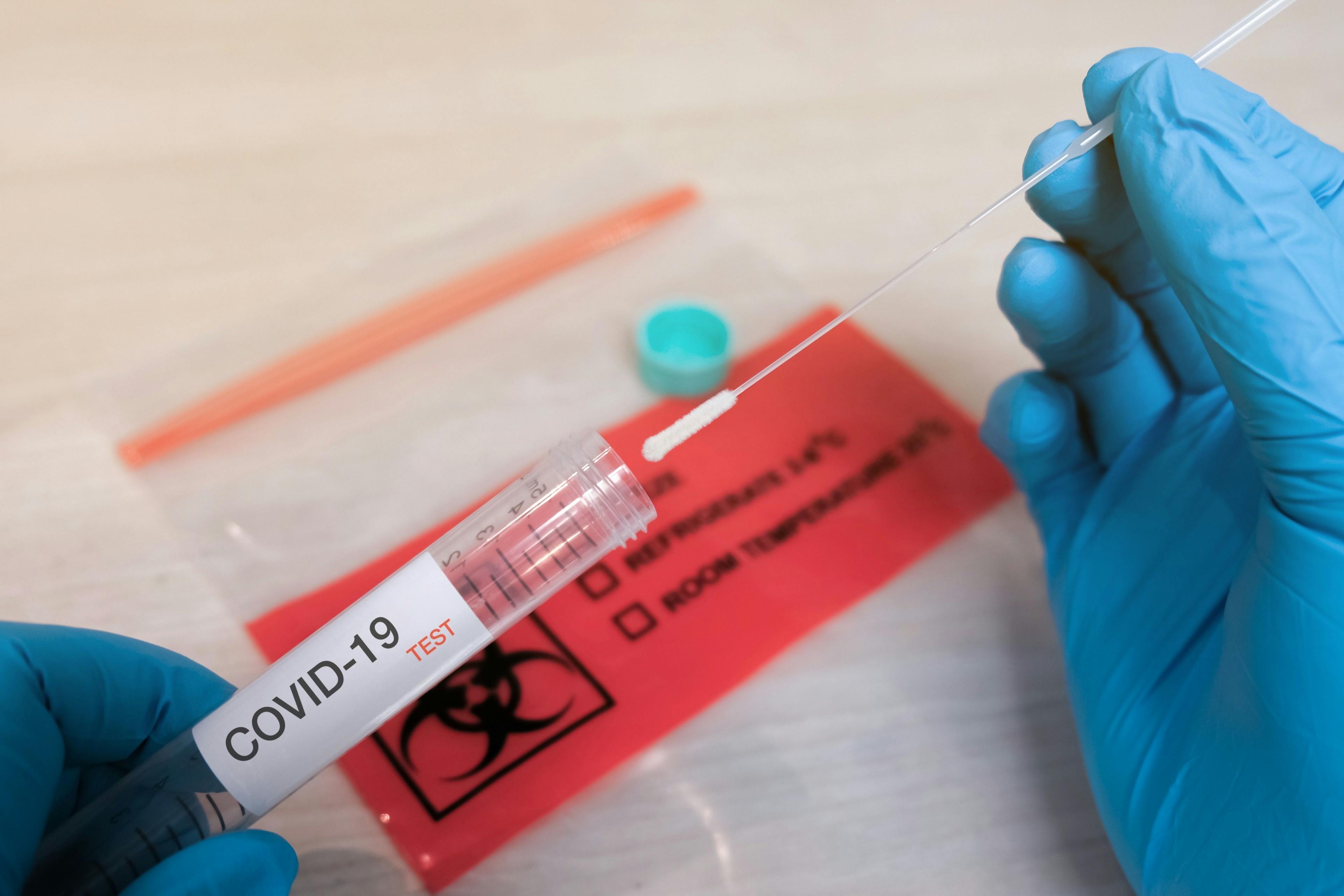 coronavirus, COVID-19 test, FDA, coronavirus test