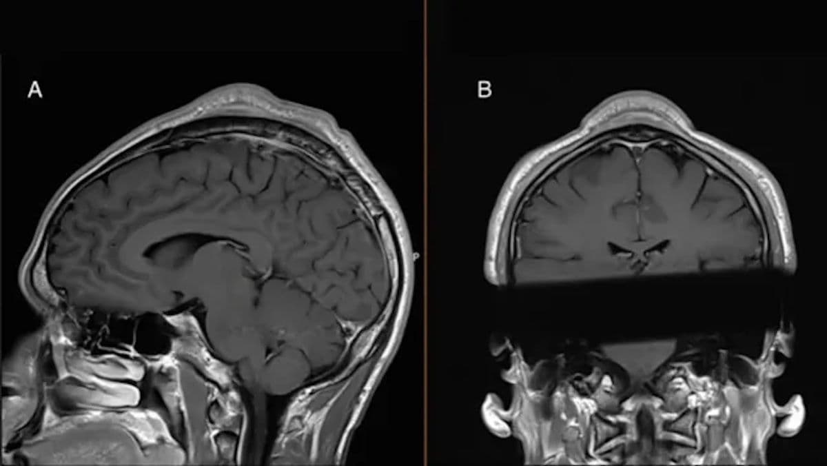 © BMJ Case Report via LiveScience.com