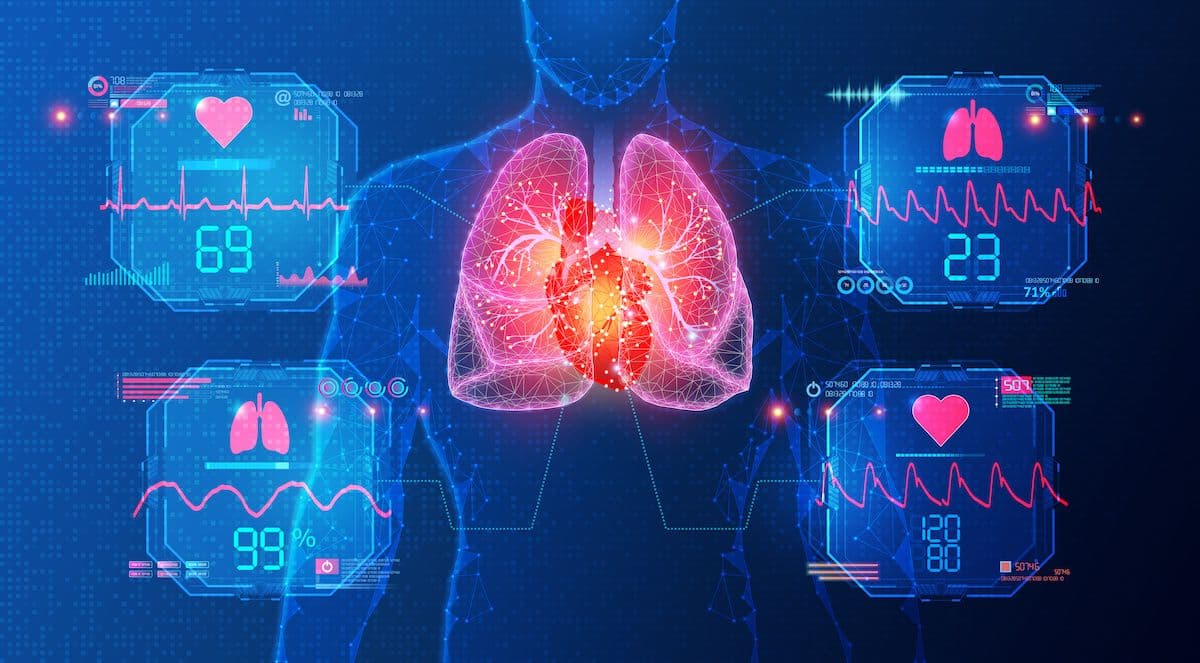 cardiopulmonary hemodynamic monitoring: © ArtemisDiana - stock.adobe.com